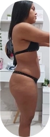 Después 6